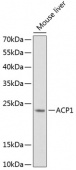 ACP1 Rabbit pAb (A12390)