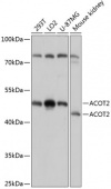 ACOT2 Rabbit pAb (A14390)