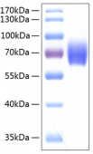 Active Recombinant Human Serpin F2/Alpha-2-antiplasmin Protein (RP00147)