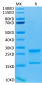 Biotinylated Recombinant Human IL-17A&IL-17F Protein (RP02415)