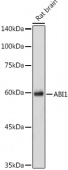 ABI1 Rabbit pAb (A16092)