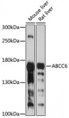 ABCC6 Rabbit pAb (A8100)