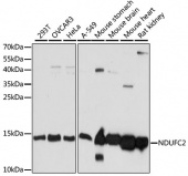 [KO Validated] NDUFC2 Rabbit pAb (A15073)