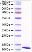Recombinant Mouse SPINK4 Protein (RP01487)