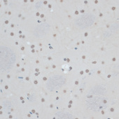 ZNF433 Rabbit pAb (A14972)