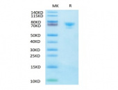 Biotinylated Recombinant Human Mesothelin/MSLN Protein (RP02449)