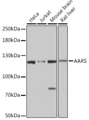 AARS Rabbit pAb (A15017)