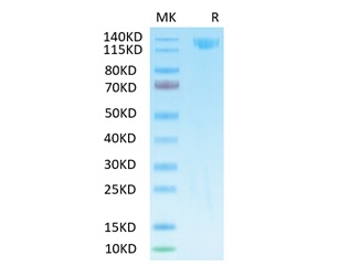 Recombinant SARS-CoV Spike S1 Protein (RP02484)
