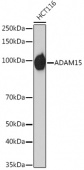 ADAM15 Rabbit mAb (A6813)