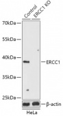[KO Validated] ERCC1 Rabbit pAb (A18066)