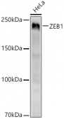 ZEB1 Rabbit mAb (A21794)