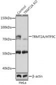 [KO Validated] TRMT2A/HTF9C Rabbit pAb (A19929)