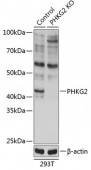 [KO Validated] PHKG2 Rabbit pAb (A19934)