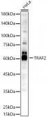 [KO Validated] TRAF2 Rabbit pAb (A23680)