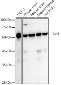 [KO Validated] AKT1 Rabbit mAb (A22770)