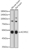 ACVR1C Rabbit pAb (A0678)