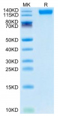 Recombinant SARS-CoV-2 Spike S1(B.1.1.529/Omicron) Protein (RP02108)