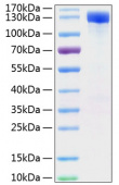 Recombinant Mouse ErbB-2/HER2/CD340 Protein (RP01166)