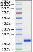 Recombinant Human GDNF Protein (RP01313)