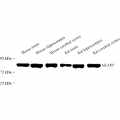 Anti -AKAP5 Rabbit pAb