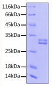 Recombinant Human Prolactin/PRL Protein (RP00435)