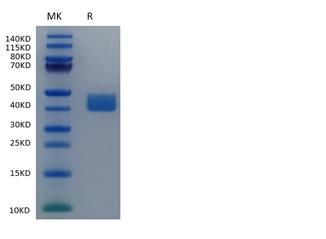 Recombinant Human Mesothelin/MSLN Protein (RP02447)