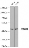 [KO Validated] CSNK1E Rabbit pAb (A1796)