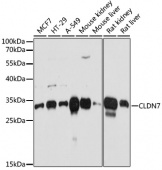 [One Step]CLDN7 Antibody Kit (RK05634)