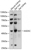 AADAC Rabbit pAb (A13936)