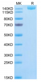 Recombinant SARS-CoV-2 Spike S1+S2 ECD(S-ECD)(B.1.1.529/Omicron) Trimer Protein (RP02111)