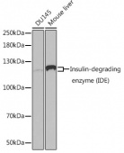 [KO Validated] Insulin-degrading enzyme (IDE) Rabbit pAb (A1630)