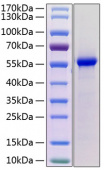 Recombinant Mouse Renin/REN1 Protein (RP02135)