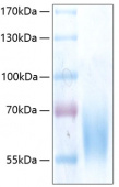 Recombinant Human Trk-B/NTRK2 Protein (RP00290)