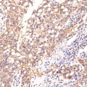 GB11932 Anti -HSF1 Rabbit pAb Antibody