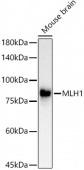 [KO Validated] MLH1 Rabbit mAb (A4858)