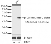 Phospho-Casein Kinase 2 alpha (CSNK2A1)-T360/S362 Rabbit pAb (AP0335)