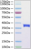 Active Recombinant Human Siglec-15/CD33L3 Protein (RP01256)