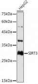 [KO Validated] SIRT3 Rabbit pAb (A17113)