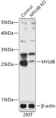 [KO Validated] MYL6B Rabbit pAb (A18102)