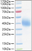 Active Recombinant Human TFPI Protein (RP01434)