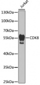 [KO Validated] CDK8 Rabbit pAb (A5548)