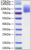 Active Recombinant Human MERTK Protein (RP01198)