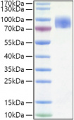 Active Recombinant Human CD200R1 Protein (RP01365)