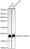 VSNL1/VILIP-1 Rabbit mAb (A22100)