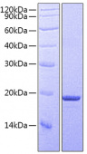 Recombinant Mouse TNFSF11/RANKL/CD254 Protein (RP00745)