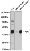 ADK Rabbit pAb (A15024)