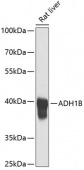 ADH1B Rabbit pAb (A1431)