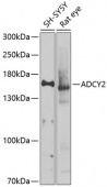 ADCY2 Rabbit pAb (A9805)