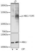 Phospho-c-Abl-Y245 Rabbit pAb (AP0001)