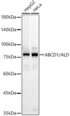 ABCD1 / ALD Rabbit mAb (A23569)